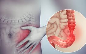 La dieta per l'intestino irritabile:  risolvilo con l'alimentazione